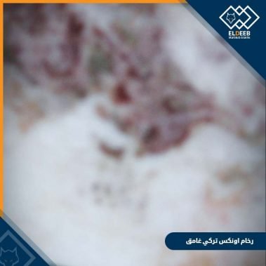 رخام اونكس تركي غامق, عينات جرانيت, عينات رخام, عينات رخام وجرانيت, انواع الرخام بالصور والاسماء, اسعار الرخام بالصور, انواع الرخام الطبيعي, افضل انواع الرخام, انواع الرخام الاسود, اسماء انواع الرخام بالصور, أنواع الرخام, انواع الرخام والجرانيت بالصور والاسعار, اسماء انواع الرخام, انواع الرخام المستورد, اشكال وانواع الرخام, أنواع الرخام الطبيعي مع الصور, اجود انواع الرخام, جميع انواع الرخام, صور انواع الرخام, افضل انواع رخام الواجهات, اجمل انواع الرخام, أنواع الرخام بالصور, انواع الرخام الاسود للمطابخ, اشكال الرخام وانواعه