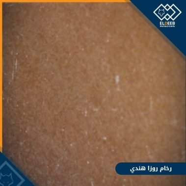 رخام روزا هندي مستورد من أجمل انواع الرخام المستورد, عينات رخام, عينات رخام وجرانيت, انواع الرخام بالصور والاسماء, اسعار الرخام بالصور, انواع الرخام الطبيعي, افضل انواع الرخام, انواع الرخام الاسود, اسماء انواع الرخام بالصور, أنواع الرخام, انواع الرخام والجرانيت بالصور والاسعار, اسماء انواع الرخام, انواع الرخام المستورد, اشكال وانواع الرخام, أنواع الرخام الطبيعي مع الصور, اجود انواع الرخام, جميع انواع الرخام, صور انواع الرخام, افضل انواع رخام الواجهات, اجمل انواع الرخام, أنواع الرخام بالصور, انواع الرخام الاسود للمطابخ, اشكال الرخام وانواعه